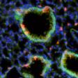 Ancient Enzyme Protects Lungs from Common Irritant Produced by Bugs and Mold